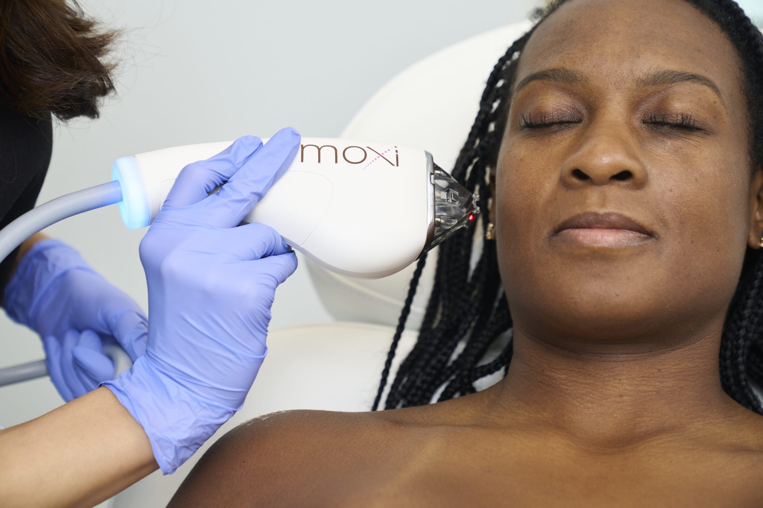 can glutathione remove hyperpigmentation Brightening from Within: How Naturally Reduces MOXI Laser for Melasma: Is