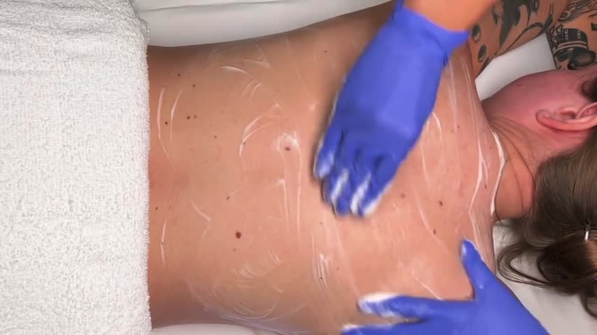 Back peel treatment at ELLEMES Medical Spa